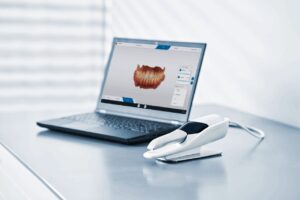 digitqal scanning with primescan at morristown cosmetic dentistry